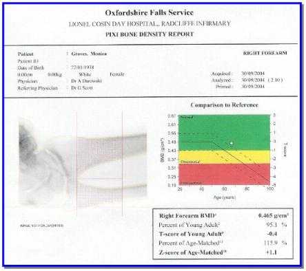 bone density scan showing density in the normal region